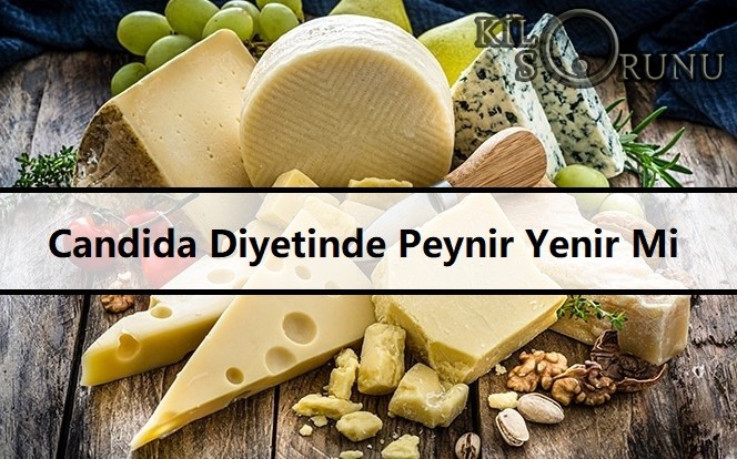 Candida Diyetinde Peynir Yenir Mi