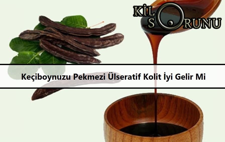 Keçiboynuzu Pekmezi Ülseratif Kolit İyi Gelir Mi