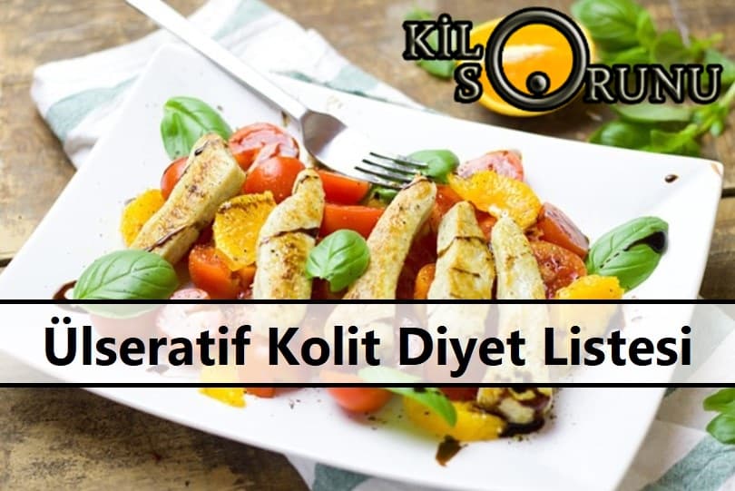 Ülseratif Kolit Diyet Listesi