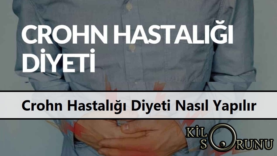 Crohn Hastalığı Diyeti Nasıl Yapılır