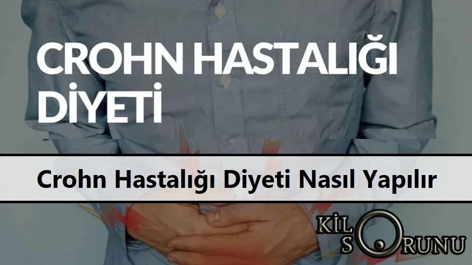 Crohn Hastalığı Diyeti Nasıl Yapılır? Crohn Hastalığına İyi Gelen Şifalı Bitkiler